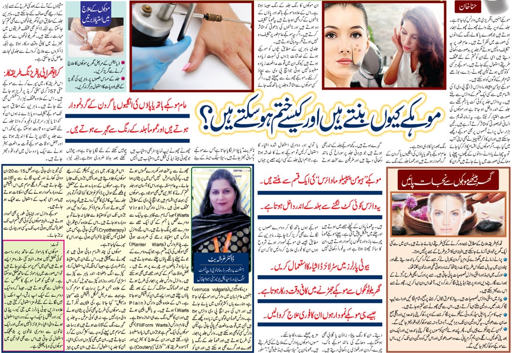 All About Warts in Urdu & English Symptoms, Causes, Preventions & Treatment 