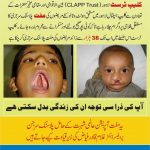 Free Plastic Surgery of Cleft Lip and Cleft Palate in Lahore